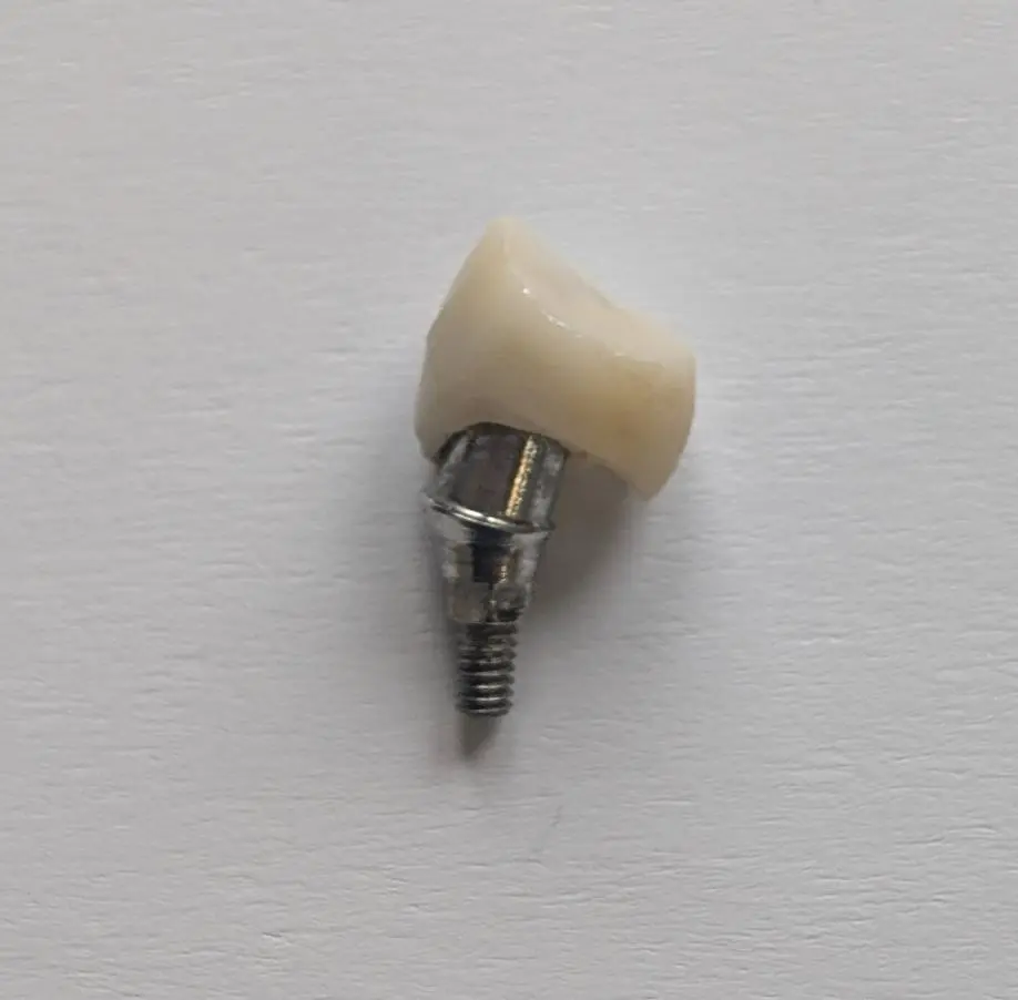 Referral implant case with repeatedly loose crown and poor prosthetic fit; deciding whether to continue treatment