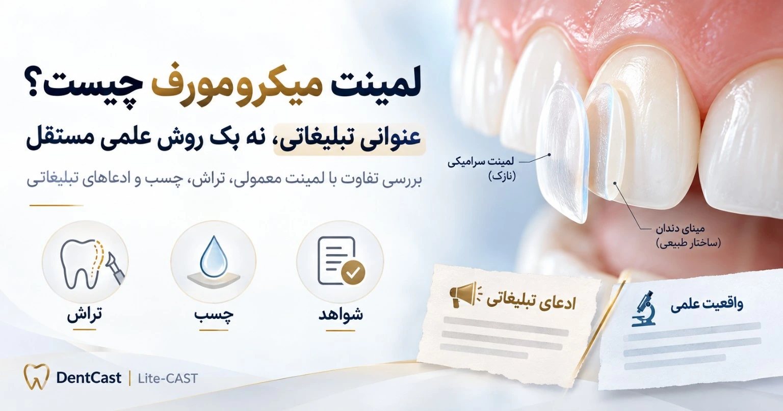 تصویر تبلیغاتیِ عنوان «لمینت میکرومورف»؛ نمایش لمینت سرامیکی روی دندان و مقایسهٔ ادعاهای تبلیغاتی با واقعیت علمی.