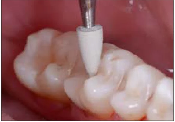 پالیش نهایی با پالیشر خاکستری
